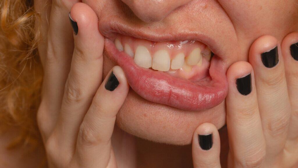 A woman cringing conveys the message in the blog post titled "Watch Your Mouth" by Robert N. Lauderdale.